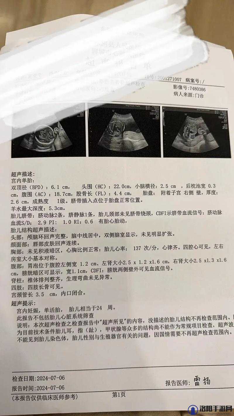 为什么做彩超时医生总问做四维没有：胎儿排畸的重要检查