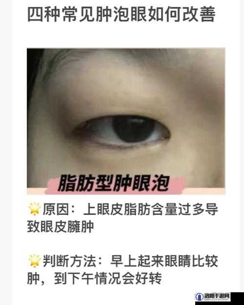 打开看看是不是肿了：快来确认是否真的肿啦